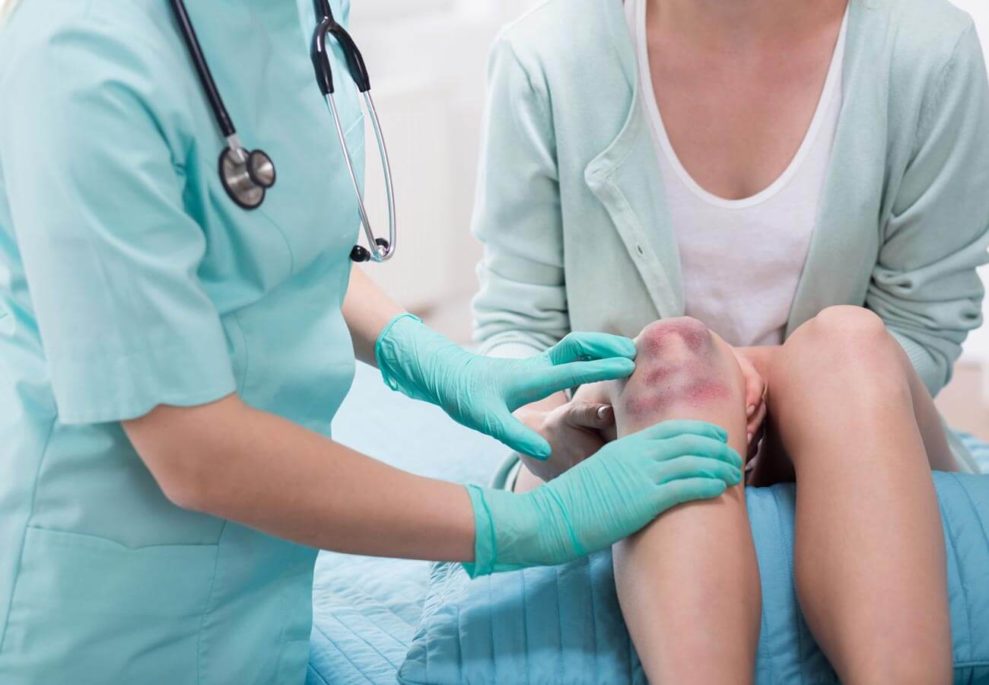 A medical professional inspects a woman's bruised knee after a slip-and-fall incident here in a Los Angeles workplace.
